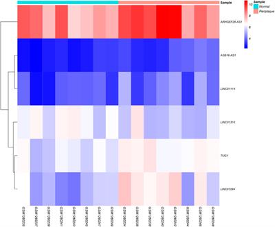 Identification of potential regulatory long non-coding RNA-associated competing endogenous RNA axes in periplaque regions in multiple sclerosis